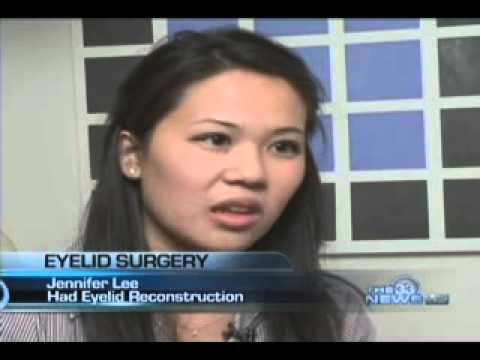 Asian Eyelid Surgery Story Featured on the CW 33 News