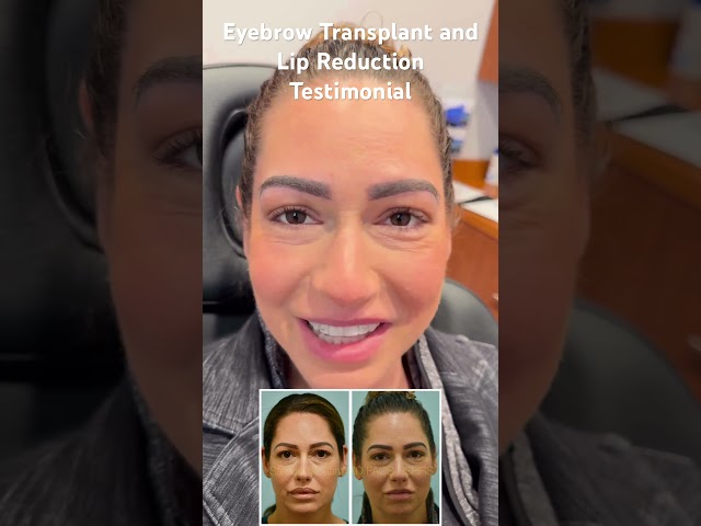 Eyebrow Transplant and Lip Reduction Testimonial