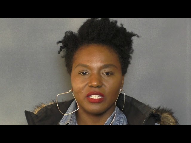 Dallas African-American Female Hair Transplant for Traction Alopecia Testimonial
