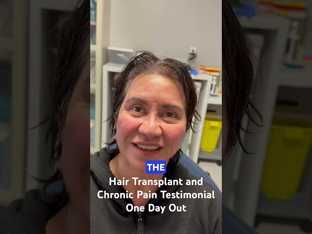 Hair Transplant and Chronic Pain Testimonial One Day Out