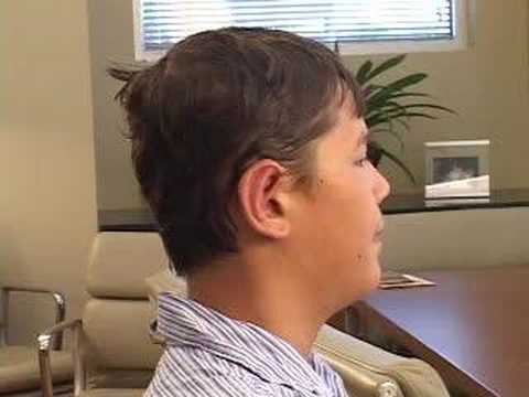 DALLAS OTOPLASTY COSMETIC EAR PINNING JOURNEY