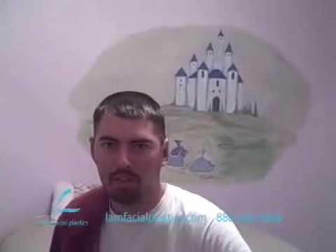 Dallas Otoplasty Video Recovery Journey
