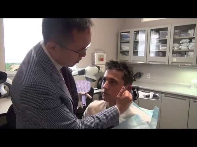 Unilateral (One-Sided) Otoplasty Cosmetic Ear Pinning