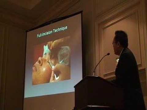 PLASTIC SURGERY:  ASIAN EYELID LECTURE IN HILTON HEAD