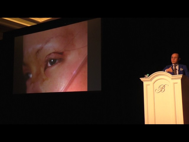 Asian Blepharoplasty & Aging Asian Eyelid Lecture by Dr. Sam Lam in Las Vegas