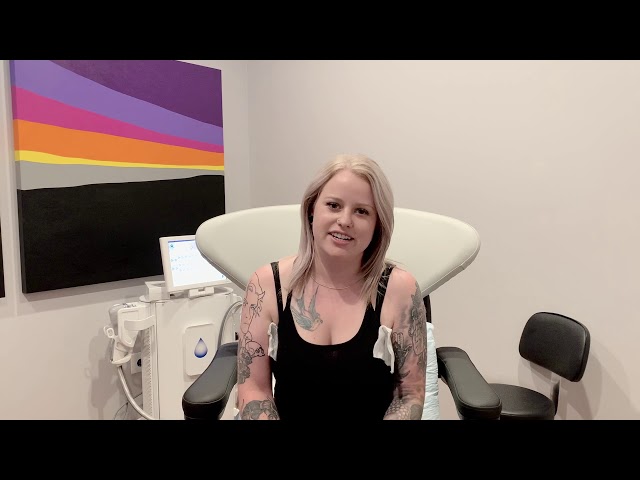 Dallas miraDry Patient Testimonial