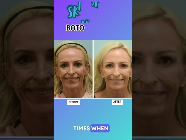 Comprehensive Tutorial on Facial Aging and Facial Rejuvenation