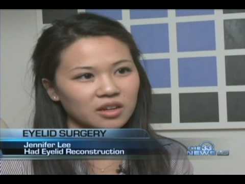 Asian Double Eyelid Blepharoplasty 33 News (Dallas, Texas)