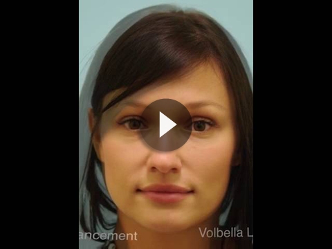 Lip Augmentation Videos