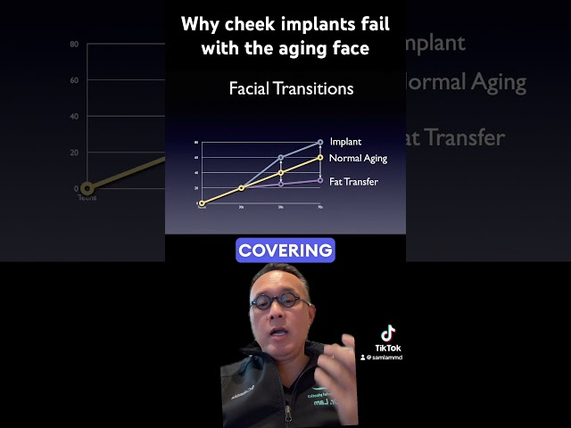 Why cheek implants fail with the aging face