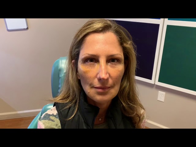 Dallas Fat Graft Eyelid Laser Recovery Video
