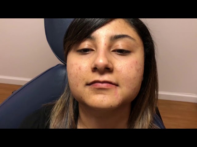 Dallas Scar Revision (Geometric Broken Line) Testimonial