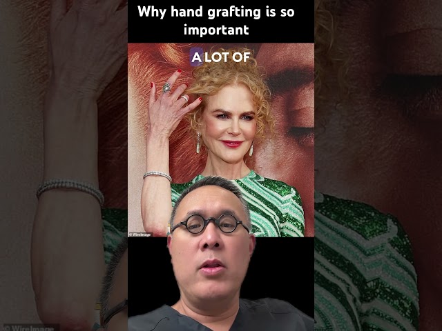 Why hand grafting is so important: Just Look at Nicole Kidman