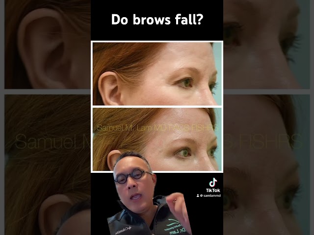 Do brows fall?
