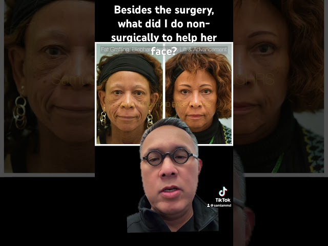 Besides the surgery, what did I do non-surgically to help her face?