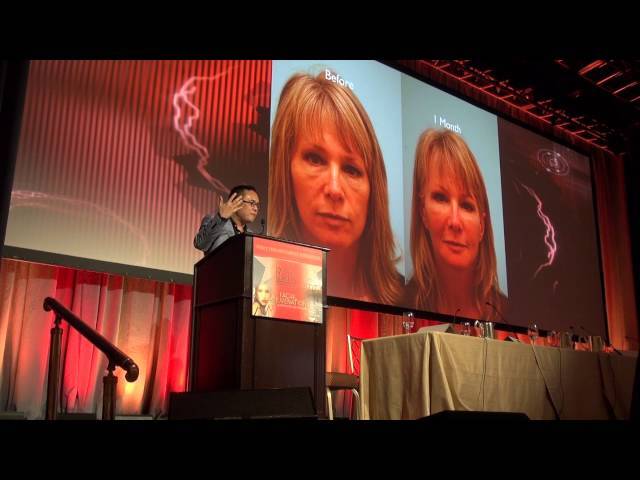 Fat Grafting Lecture in Beverly Hills, California by Dr. Sam Lam