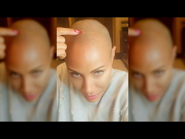 WATCH: Dr.Lam explaining alopecia after Will Smith Oscars controversy