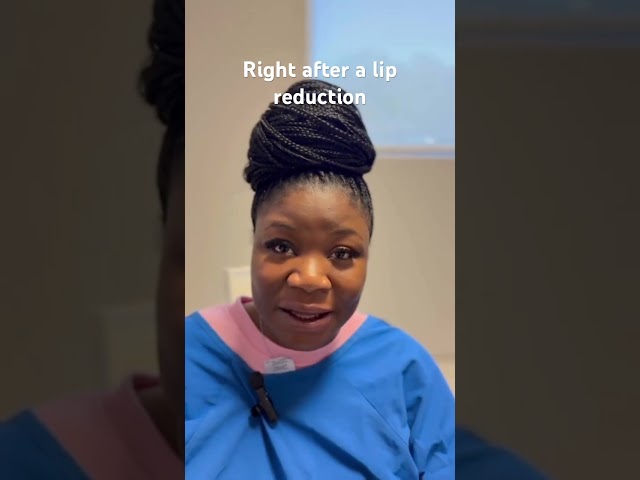 Right after a lip reduction #lipreduction #blacklipreduction