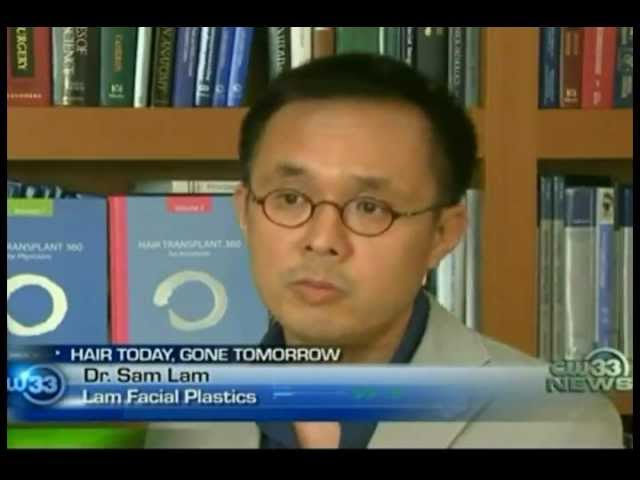 Platelet Rich Plasma (PRP) and Acell Use in Hair Transplant/Hair Restoration