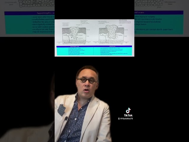 Hypertrophic Scar vs Keloid Quick Comparison