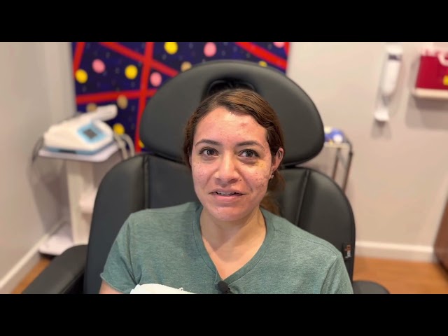 Botox to Reduce Acne & Redness (One Session) Testimonial