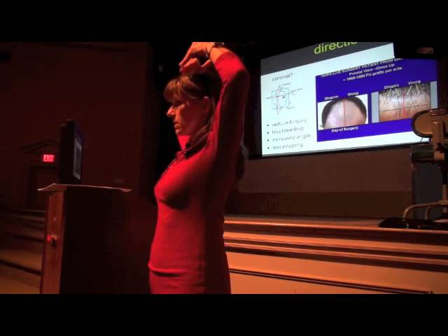Emina Karamanovski talks about methods to improve graft survival during hair restoration procedures
