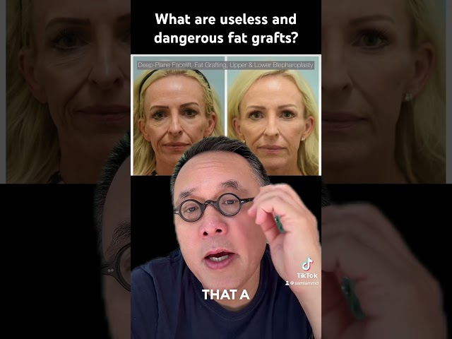 What are useless and dangerous fat grafts?
