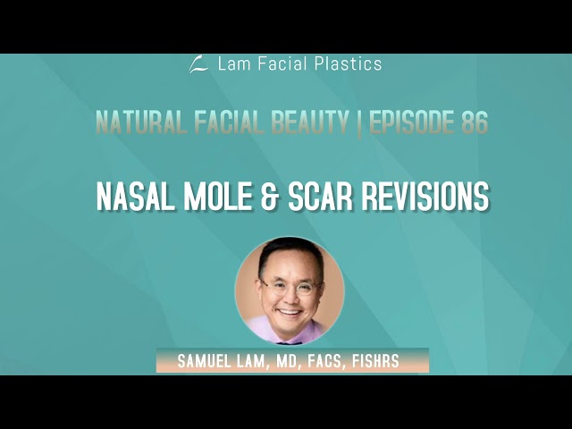 Dallas Cosmetic Surgery Podcast: Nasal Mole & Scar Revisions