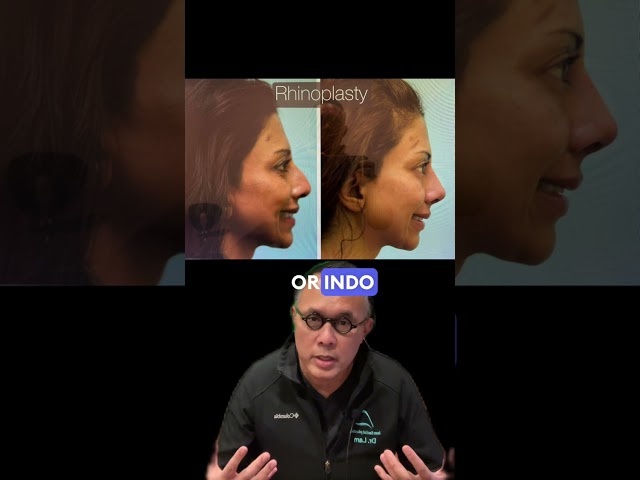 What Makes an Indo-Pakistani Rhinoplasty Different?