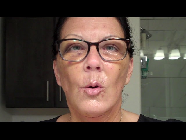 Dallas Facelift/Chin Implant/Lower Blepharoplasty/Lower-Lid Laser/Dermabrasion Recovery