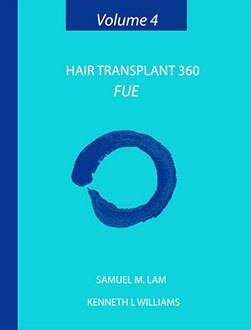 Hair Transplant 360 Hair Transplant 360