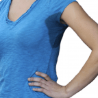 Image of a MiraDry patient