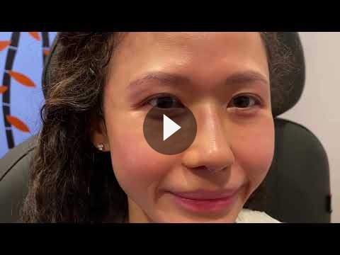Asian Rhinoplasty Videos