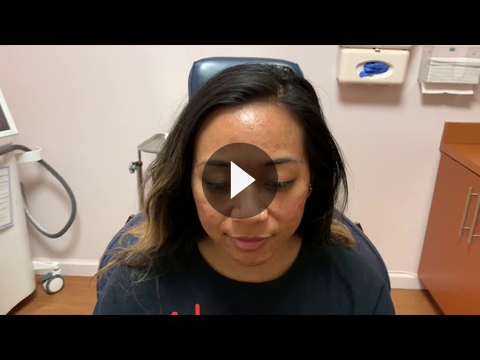 Asian Rhinoplasty Videos