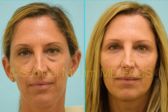patient testimonial before and after