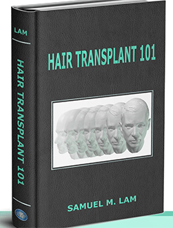 Hair Transplant 101 Hair Transplant 101